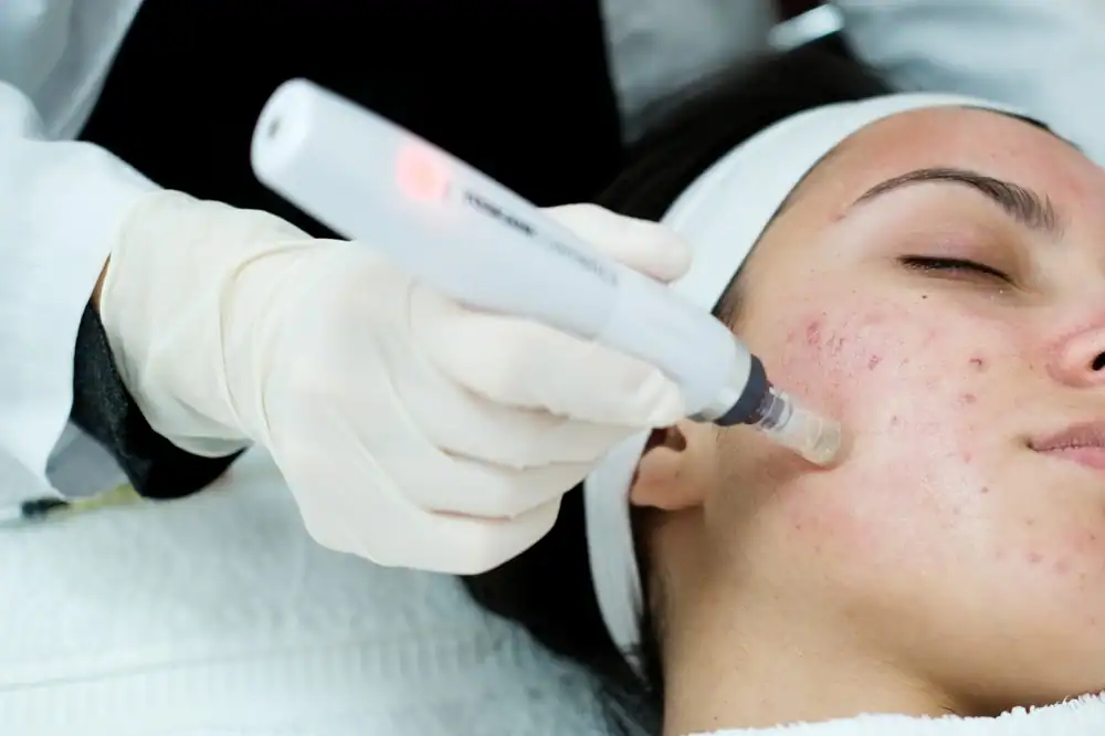 A professional esthetics student at AVI Career Training performs a high-quality facial microdermabrasion procedure on a client. The client lies comfortably on a treatment bed with eyes closed, while the student uses a specialized handheld device to gently exfoliate the skin. The clinic setting is clean, modern, and well-equipped, reflecting the professional training environment and focus on advanced skincare techniques.